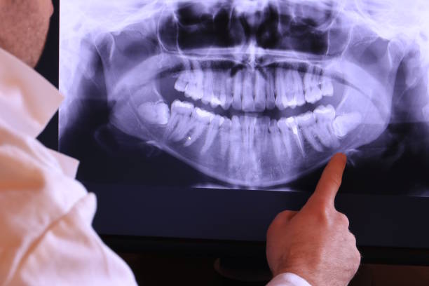 Best Emergency Treatment for Toothache in St Albans, VT